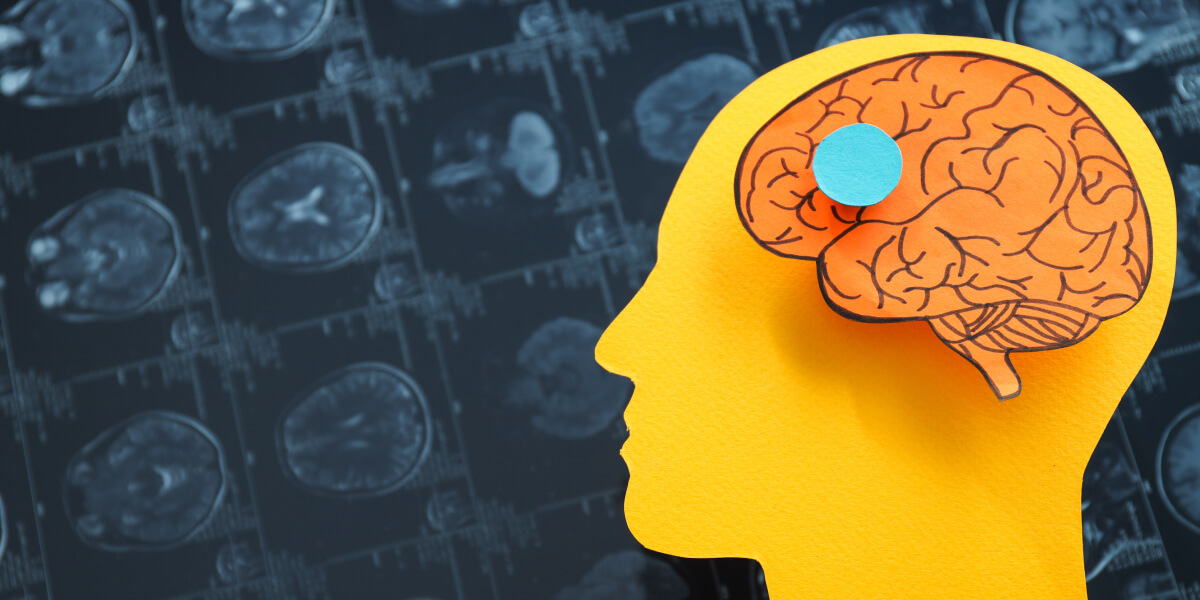 MRI images or magnetic resonance imaging with paper human head and brain.